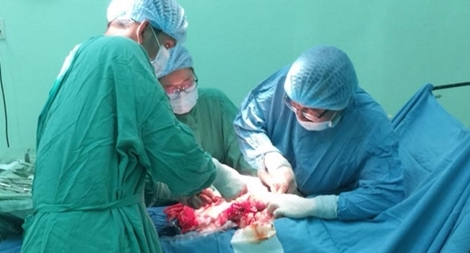 Phẫu thuật khối u xơ tử cung "khổng lồ"