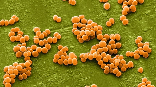 Hơn 200 công nhân ngộ độc do nhiễm độc tố vi khuẩn tụ cầu vàng