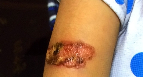 Giám định thương tật cho bé gái nghi bị bạo hành ở Kiên Giang