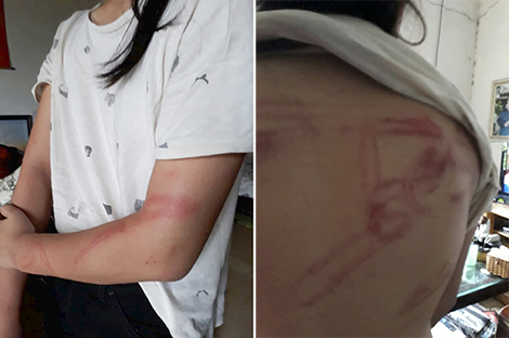 Lá đơn kêu cứu của bà ngoại có hai cháu bị bố đẻ bạo hành