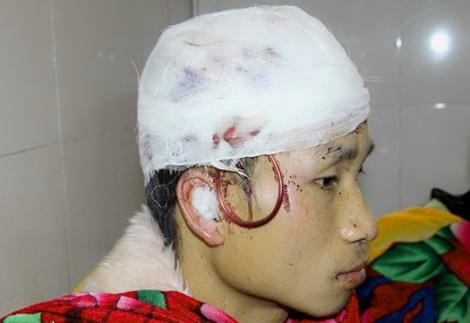 Giả chết, một thanh niên giữ được mạng khi bị gấu tấn công