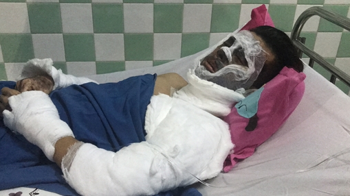 Thêm thông tin về hung thủ trong vụ tạt axit, cắt gân chân Việt Kiều ở Quảng Ngãi