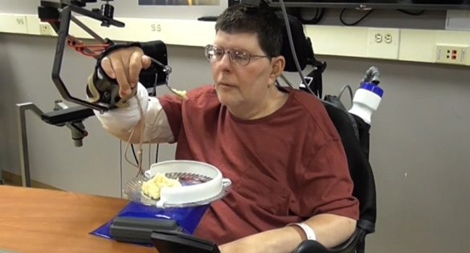 Hy vọng mới cho người bị liệt tứ chi