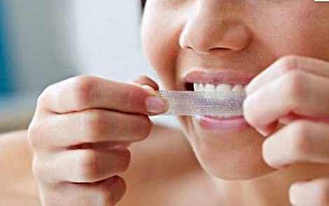 Coi chừng răng đi đằng răng lợi đi đằng lợi khi sử dụng miếng dán trắng răng
