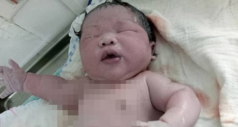 Bé trai khổng lồ ở Vĩnh Phúc chào đời nặng 7,1kg