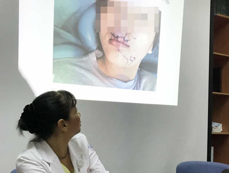 Xót xa một vụ tai nạn học đường