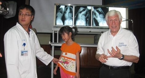 Chuyên gia hàng đầu thế giới sang Việt Nam phẫu thuật cho trẻ vẹo cột sống