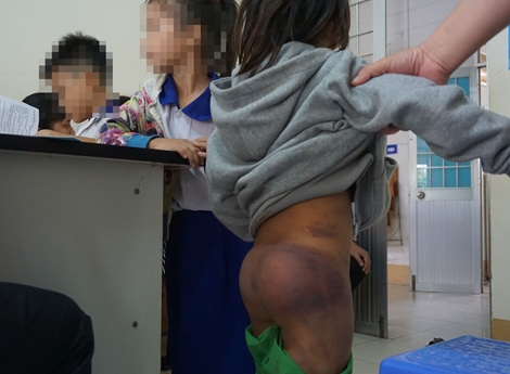 Công an vào cuộc vụ 4 học sinh nghi bị bạo hành 