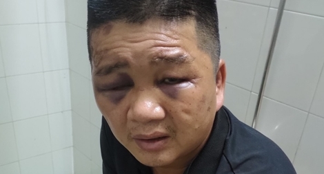 Đối tượng truy nã có 6 tiền án móc cốp xe trộm 100 triệu đồng